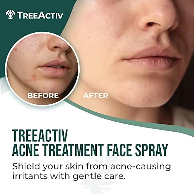 TreeActiv ACNE TREATMENT FACE SPRAY, 4 FL OZ | REDUCES OCCURRENCE OF HORMONAL, SEVERE, & CYSTIC ACNE, CLARIFYING SALICYLIC ACID FACE MIST FOR MEN & WOMEN | PORE MINIMIZER FOR FACE | 1000+ SPRAYS - Image 2
